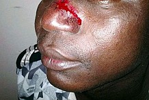 Yopougon : Un officier de police tabassé par des apprentis-chauffeurs